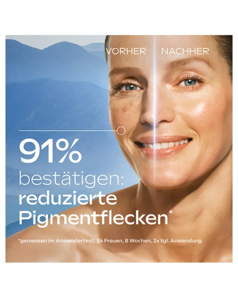 Anti-Pigmentflecken Bright Serum Serum 30 ml