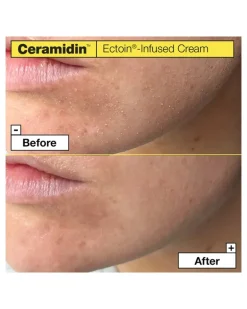Ceramidin Ectoin-Infused Cream Gesichtscreme 50 ml